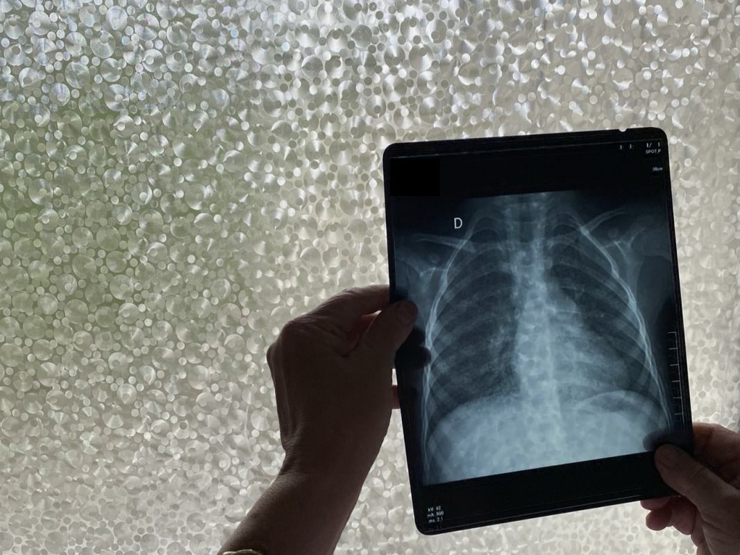 studiul clinic PARADIGM4TB